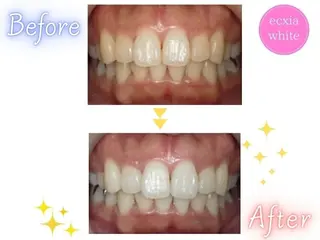 セルフホワイトニング エクシア五反田店のその他イメージ