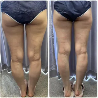 FLEUR大阪・整体 ・ハイフ・痩身・小顔のエステ・リラクイメージ