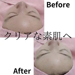 メンズ ユニセックスエステサロンUniclear所属・男女エステ ユニクリアのエステ・リラクイメージ