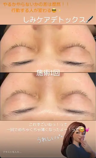 LiZA エステティックサロンのエステ・リラクイメージ