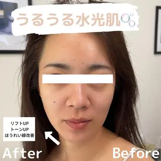 lafleur Yurinaのエステ・リラクイメージ