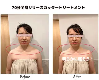 痩身×フェイシャル ブライダル|Linoのエステ・リラクイメージ