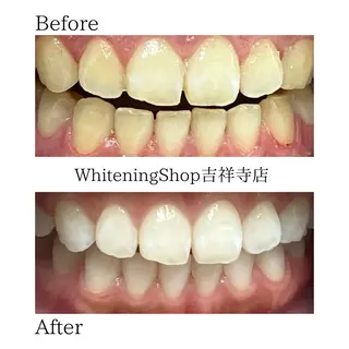 ホワイトニング ショップ吉祥寺店のエステ・リラクイメージ