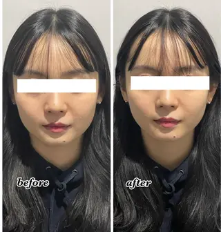 ENCHANT 脱毛.小顔.毛穴のエステ・リラクイメージ