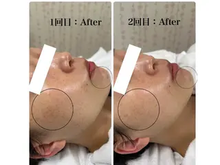 Astorie 相模大野エステのその他イメージ