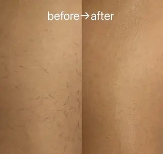 メンズ まつげパーマ×眉毛×脱毛　Cerise Lala所属・まつげパーマ眉毛脱毛 スリーズララ大船店のエステ・リラクイメージ