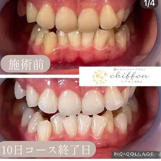 歯科レベルの白さ💎 ✨ホワイトニング岡崎のエステ・リラクイメージ