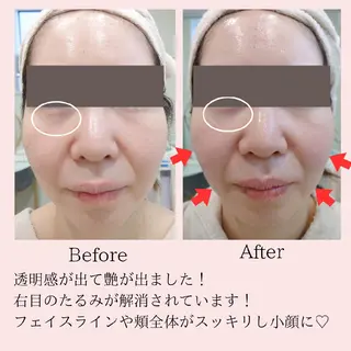 PRETTIEST SHINE所属・山田 浩子のエステ・リラクイメージ