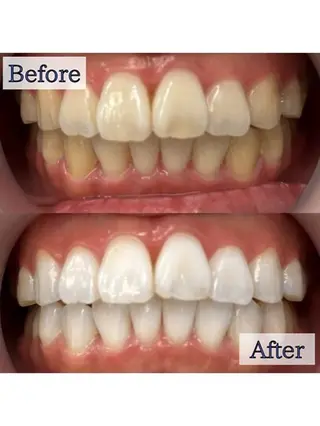 LBSホワイトニング上野店所属・LBSホワイトニング 🌐 上野店公式のエステ・リラクイメージ