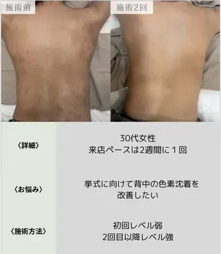 脱毛・眉毛・フェイス サロンN久留米店のその他イメージ