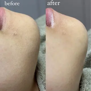 beautysalonW所属・beauty salonWのエステ・リラクイメージ