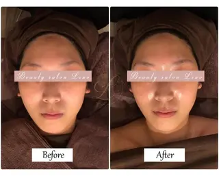 痩身×フェイシャル ブライダル|Linoのエステ・リラクイメージ