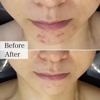 N eye beauty 高丘店所属・N  eye beauty高丘のエステ・リラクイメージ