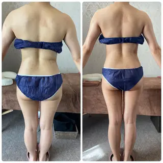 FLEUR大阪・整体 ・ハイフ・痩身・小顔のエステ・リラクイメージ