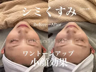 Esthetics911所属・Esthetics 911横浜のエステ・リラクイメージ