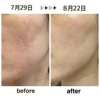 salon ace所属・【小顔矯正】 salonaceのエステ・リラクイメージ