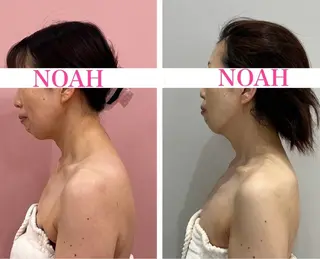 NOAH 小顔毛穴　川越店所属・NOAH ORIEのエステ・リラクイメージ