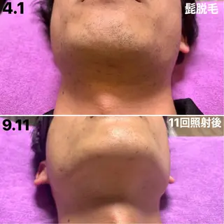 メンズ 脱毛＆エステサロン【アンリミット】所属・森谷 莉美のエステ・リラクイメージ