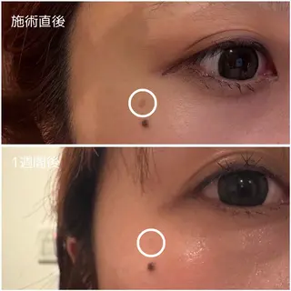 MORE BEAUTY ESTHE 本通り店所属・【シミ・シワ専門店】 山本 藍美のエステ・リラクイメージ