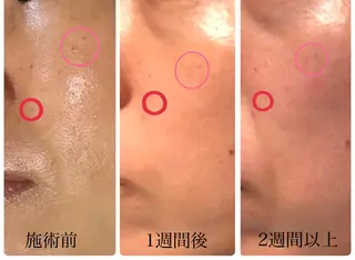 バストアップ専門/ ボディケア/小顔のエステ・リラクイメージ