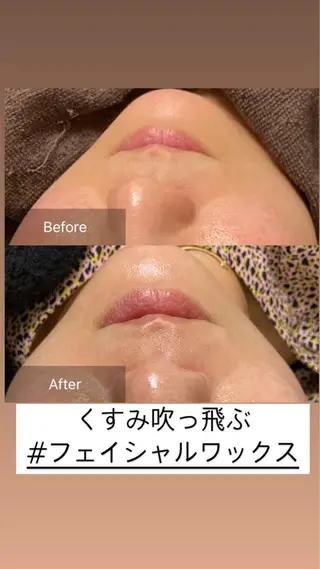 産毛専門店 Bittoのエステ・リラクイメージ