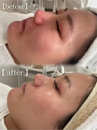 URARA 【lazo】のマツエク・マツパデザイン