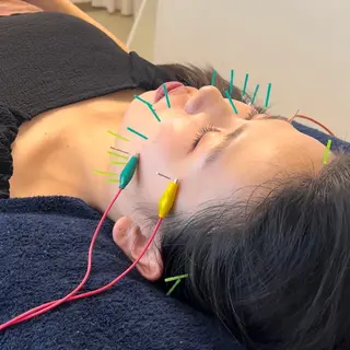 美容鍼×小顔×姿勢× ブライダル整体のエステ・リラクイメージ