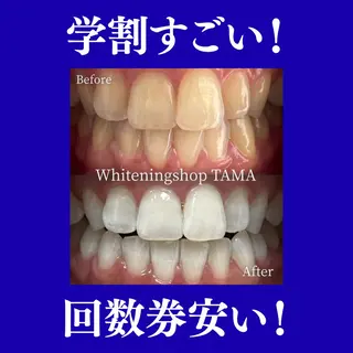 ホワイトニング ショップ多摩店のその他イメージ