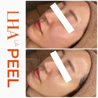 ハーブピーリング専門 BIOEL横浜のエステ・リラクイメージ