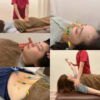 美容鍼灸Solana所属・肌質改善×美容鍼 ゆいのエステ・リラクイメージ