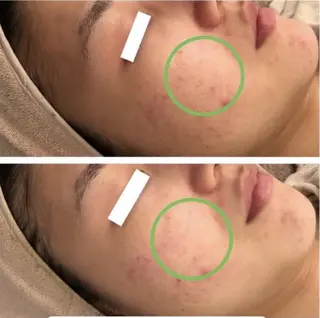 ✨美肌水光✨ アトリエリュバンのエステ・リラクイメージ