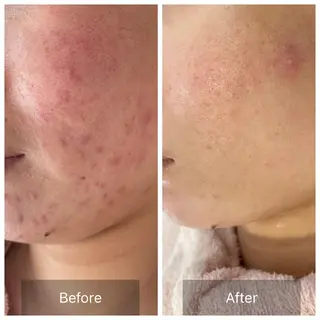 〈etre〉トータルビューティーサロン所属・etre - 韓国肌管理 -のエステ・リラクイメージ