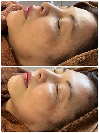 FLEUR大阪・整体 ・ハイフ・痩身・小顔のエステ・リラクイメージ