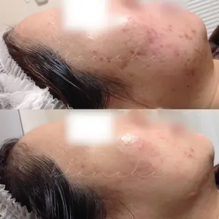 ロング カラー パーマ ヘアアレンジ ネイル マツエク・マツパ アイブロウ 都度払い肌質改善 &脱毛Blancheのエステ・リラクイメージ