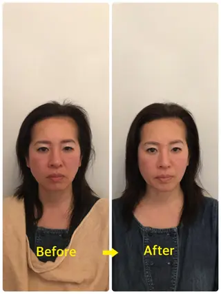 小顔矯正専門 町田 /鈴木友実のエステ・リラクイメージ