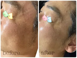 エル美容室所属・oshima yuukiのマツエク・マツパデザイン