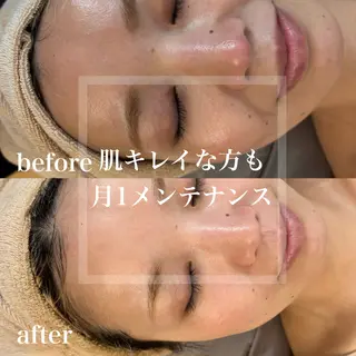 WHITE AQUA 北千住店のエステ・リラクイメージ