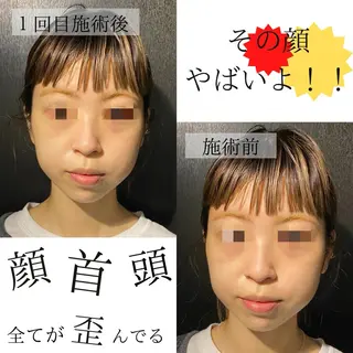 ハーブピーリング・毛穴ケア専門サロンSalon de LENA所属・ハーブピーリング 専門店/名古屋駅前店のエステ・リラクイメージ