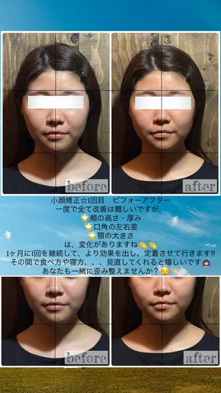 💎後悔させない小顔 矯正💎イトヤマ🌱のエステ・リラクイメージ