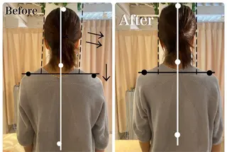 鍼灸整骨院Refine所属・鍼灸 Refineのその他イメージ