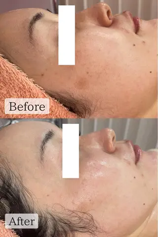 肌質改善専門サロン Bellmi/心斎橋のエステ・リラクイメージ