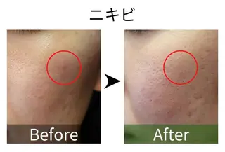 MyFairLady miuのエステ・リラクイメージ