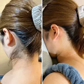 うなじ脱毛/美肌脱毛 LABELのエステ・リラクイメージ