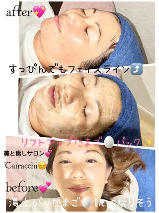 Tairacchi タイラッチのエステ・リラクイメージ