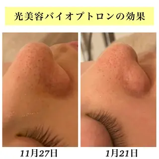 Bellesthe (ベルエステ)のエステ・リラクイメージ