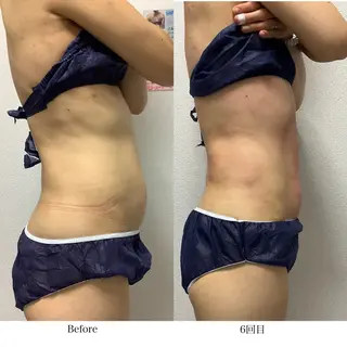 冷却専門店 SLARIのエステ・リラクイメージ