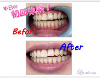 セルフホワイトニングサロン　ラヴィアン所属・ホワイトニングサロン La vie enのその他イメージ