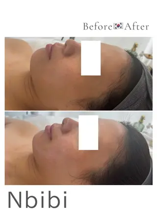 韓国🇰🇷価格 サロン_Nbibiのエステ・リラクイメージ