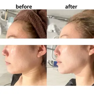 DahliaBeauty ダリアビューティー所属・DahliaBeau tyフェイシャル中村のエステ・リラクイメージ