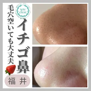 毛穴ケア専門サロン Yourmeユアミーのエステ・リラクイメージ